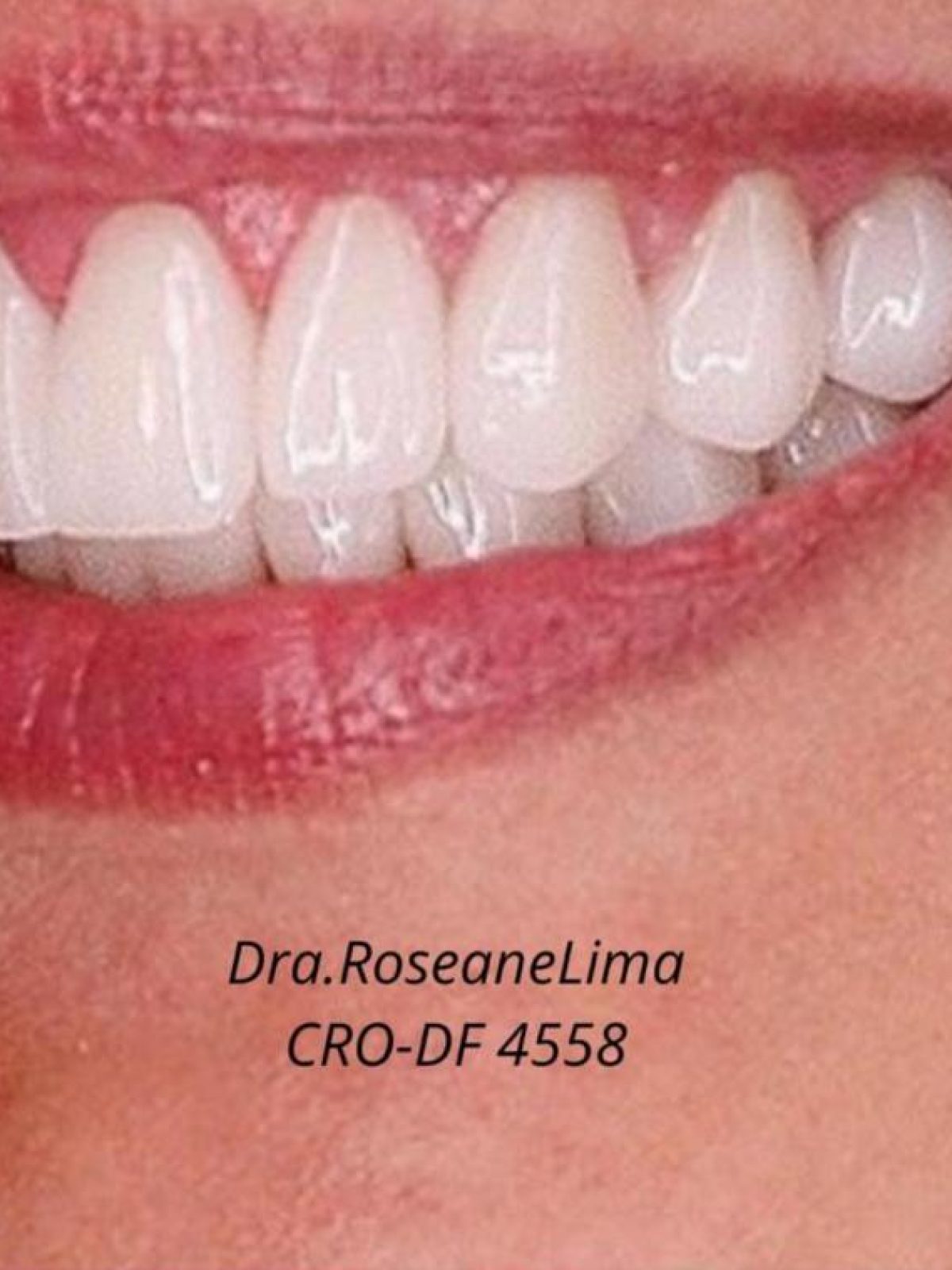 Dra. Roseane Lima1