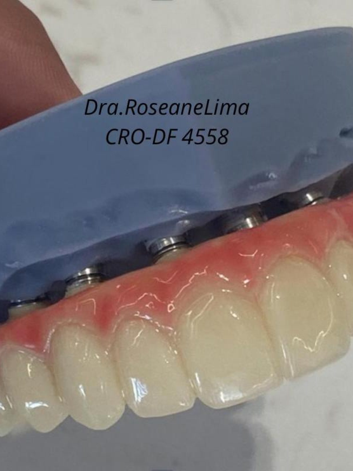 Dra. Roseane Lima2